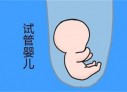 培养泉州捐卵宝宝艺术细胞的小技巧